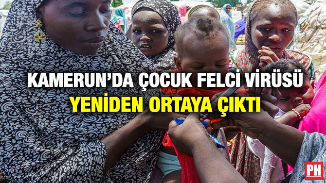 Kamerun’da Çocuk Felci Virüsü Yeniden Ortaya Çıktı