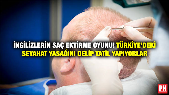İngilizlerin Saç Ektirme Oyunu! Türkiye’deki Seyahat Yasağını Delip Tatil Yapıyorlar