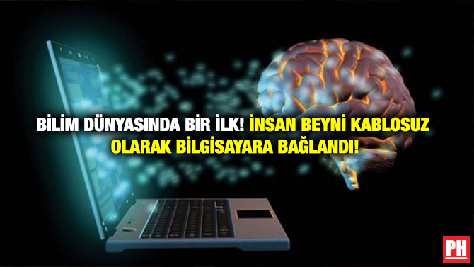 Bilim Dünyasında Bir İlk! İnsan Beyni Kablosuz Olarak Bilgisayara Bağlandı!