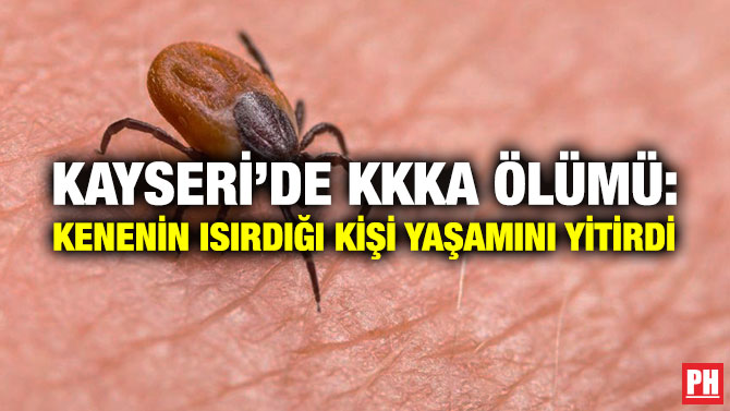 Kayseri’de KKKA Ölümü: Kenenin Isırdığı Kişi Yaşamını Yitirdi