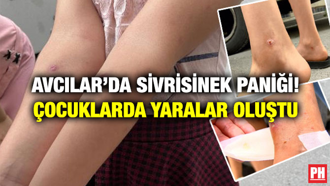 Avcılar’da Sivrisinek Paniği! Çocuklarda Yaralar Oluştu