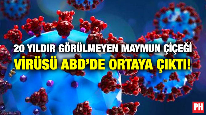 20 Yıldır Görülmeyen Maymun Çiçeği Virüsü ABD’de Ortaya Çıktı!
