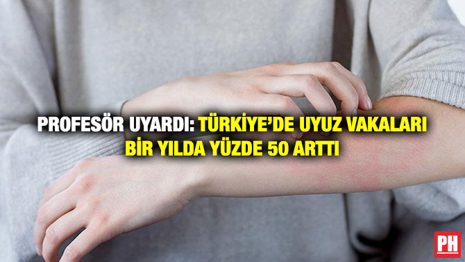 Profesör Uyardı: Türkiye’de Uyuz Vakaları Bir Yılda Yüzde 50 Arttı