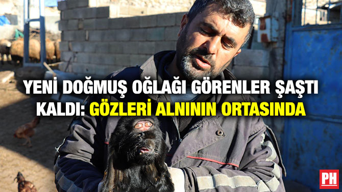 Yeni Doğmuş Oğlağı Görenler Şaştı Kaldı: Gözleri Alnının Ortasında