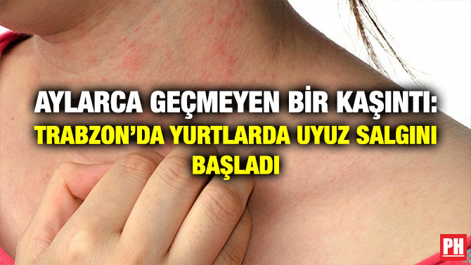 Aylarca Geçmeyen Bir Kaşıntı: Trabzon’da Yurtlarda Uyuz Salgını Başladı