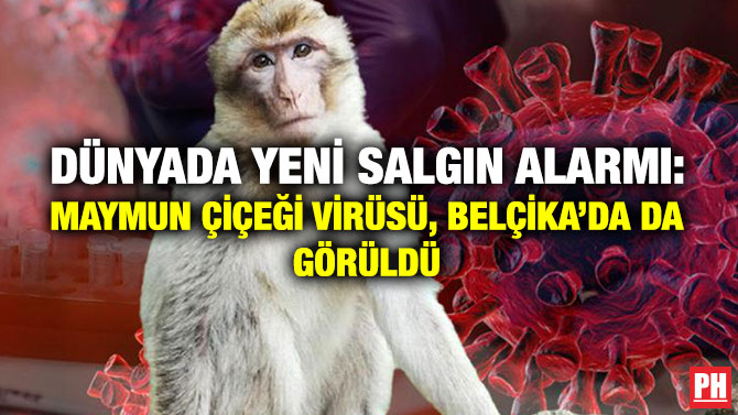 Dünyada Yeni Salgın Alarmı: Maymun Çiçeği Virüsü, Belçika’da da Görüldü