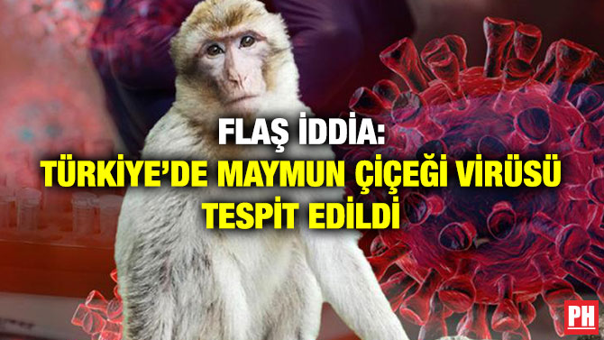 Flaş İddia: Türkiye’de Maymun Çiçeği Virüsü Tespit Edildi