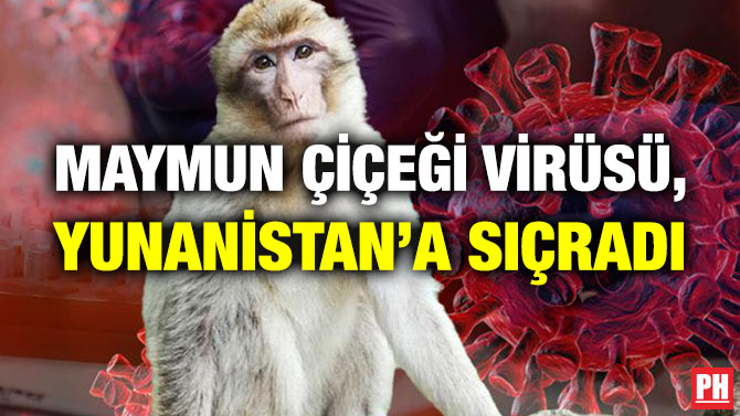 Maymun Çiçeği Virüsü, Yunanistan’a Sıçradı