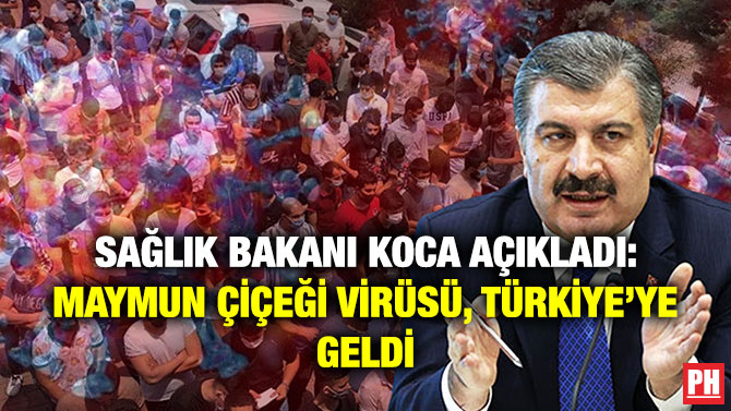 Sağlık Bakanı Koca Açıkladı: Maymun Çiçeği Virüsü, Türkiye’ye Geldi