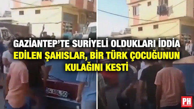 Gaziantep’te Suriyeli Oldukları İddia Edilen Şahıslar, Bir Türk Çocuğunun Kulağını Kesti