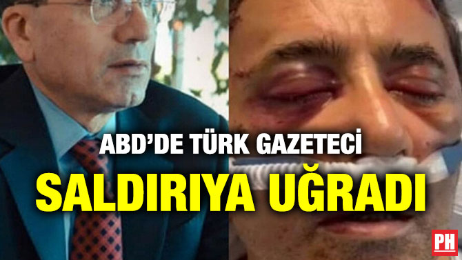 ABD’de Türk Gazeteci Saldırıya Uğradı